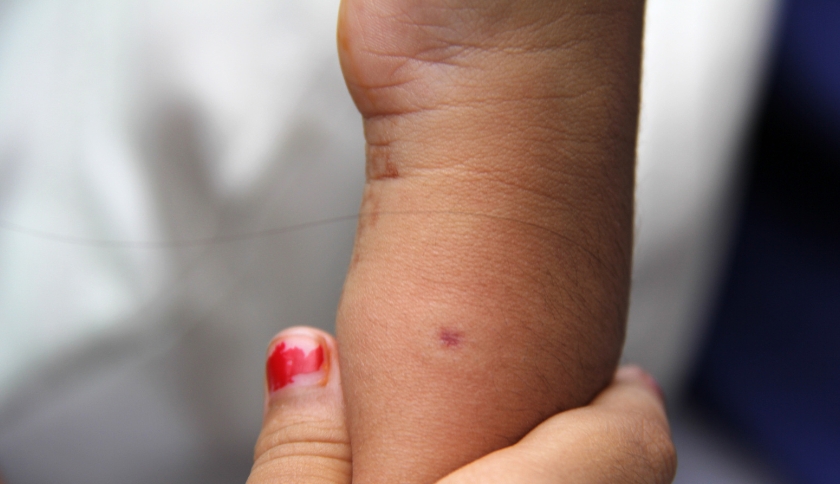 Criança de 9 anos sofre ataque brutal de abelhas em Catalão