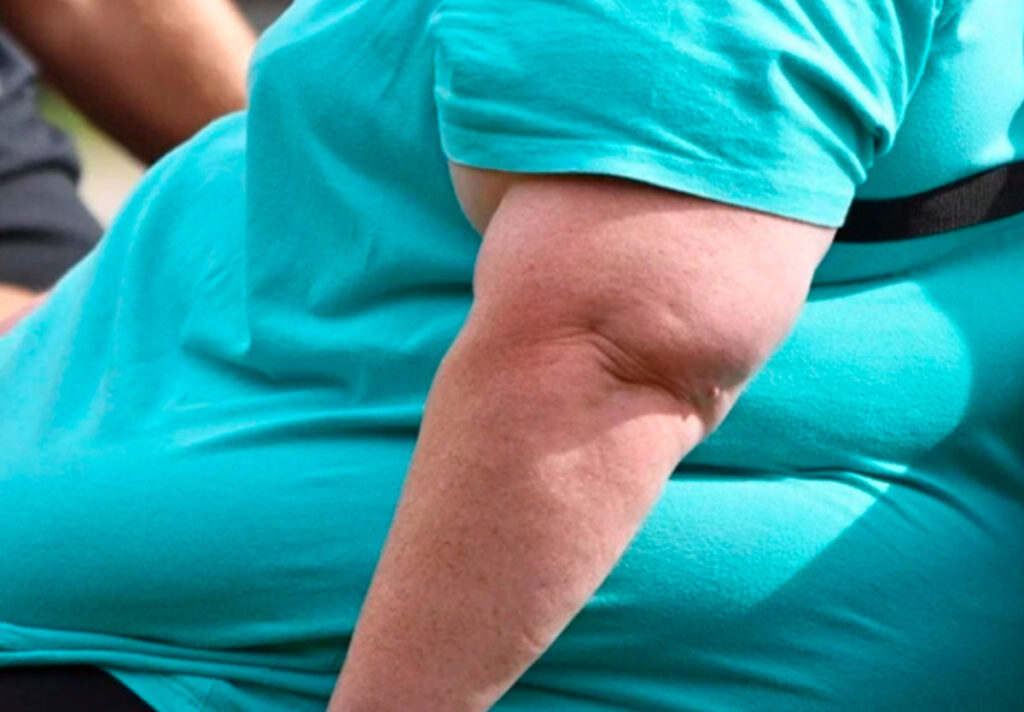 Obesidade e hipertensão crescem entre os goianos, aponta pesquisa